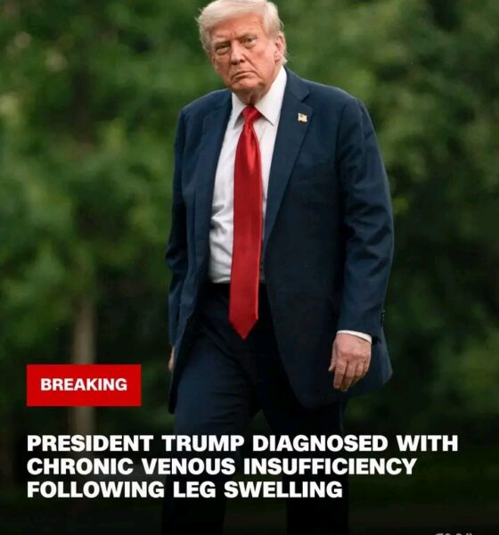 BREAKING NEWS: White House doctors diagnosed Donald Trump with chronic venous insufficiency, though the physicians said the US president remained in “excellent health,” Press Secretary Karoline Leavitt said... See More